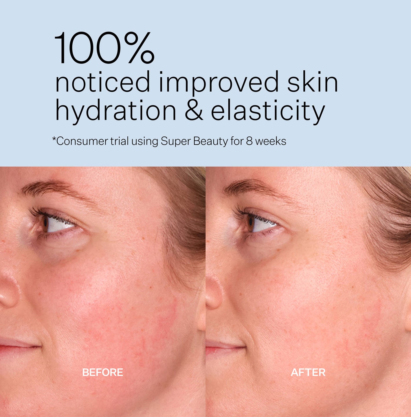 Super Beauty | With Hyaluronic Acid | Two Islands