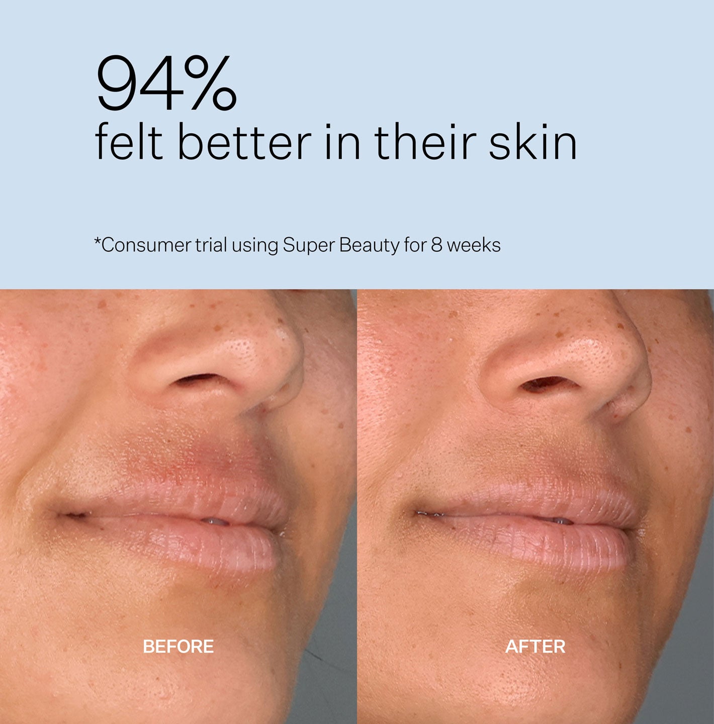 Super Beauty | With Hyaluronic Acid | Two Islands