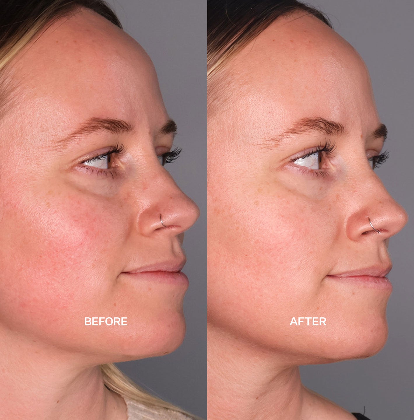 Super Beauty | With Hyaluronic Acid | Two Islands